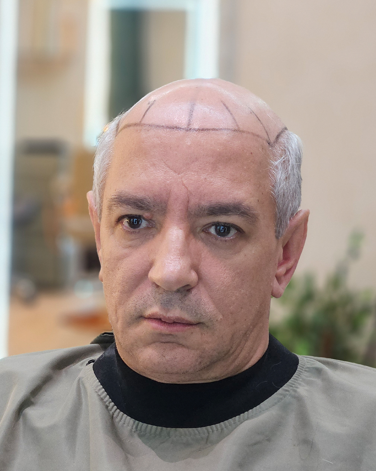 Antes